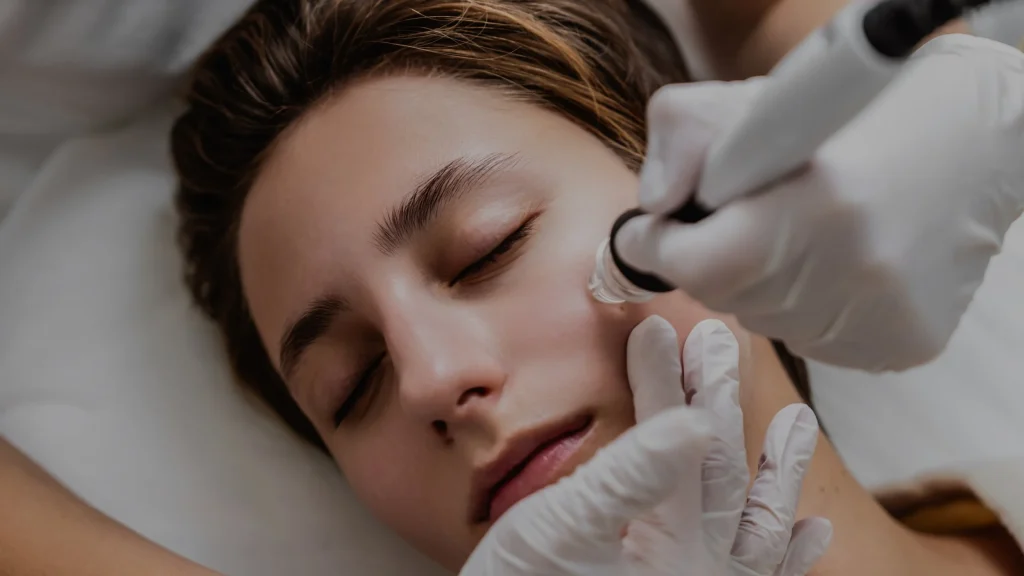 Microdermabrasion facial Queens NY
